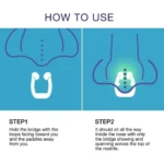 anti snoring device details