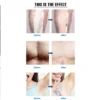 At-home hair removal UK
