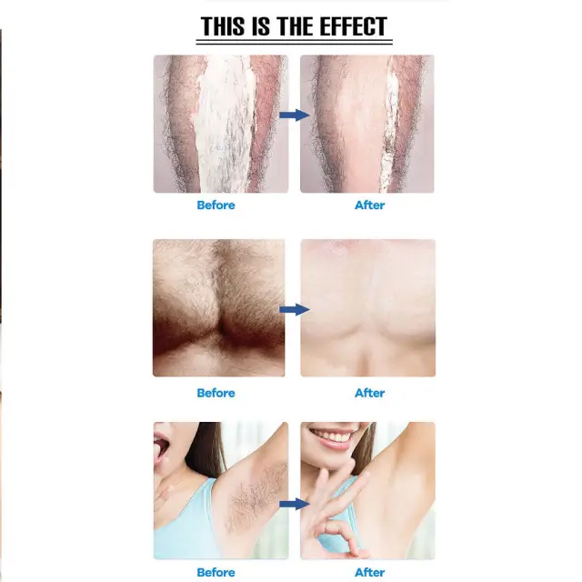 At-home hair removal UK