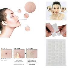 Hydrocolloid Acne Patches