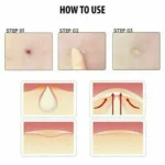 acne patches uk