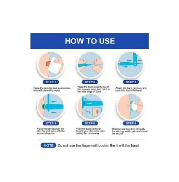 home skin tag removal