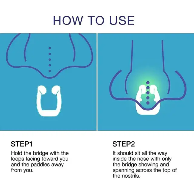 snoring solution without surgery UK