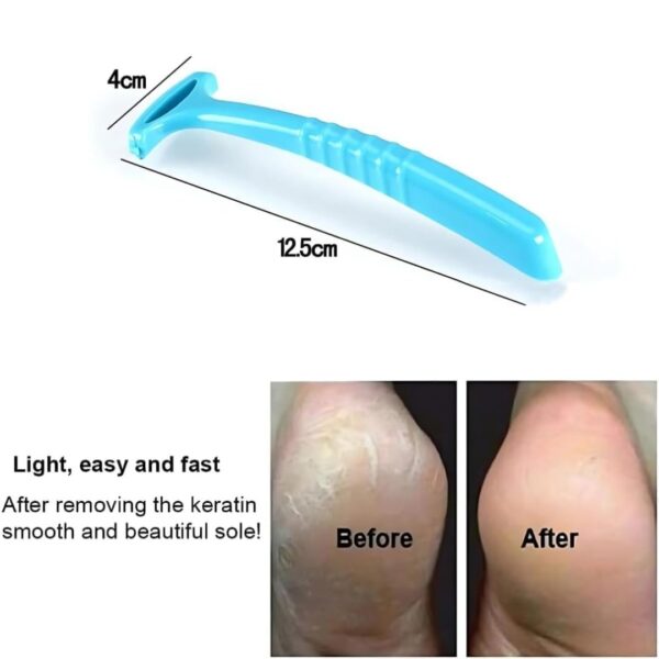foot callus remover shaver (4)