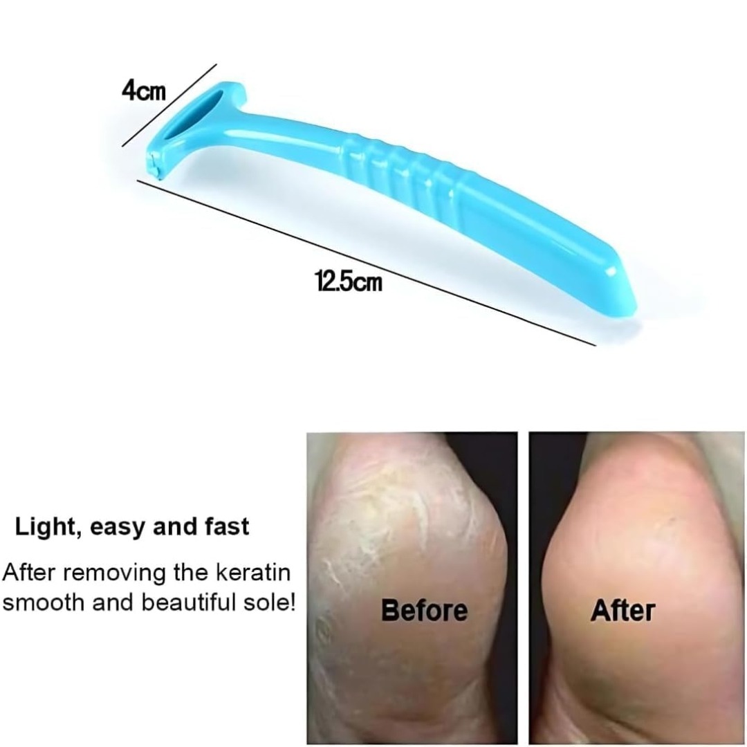 foot callus remover shaver (4)